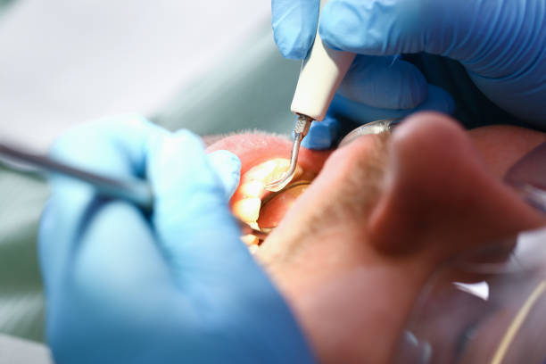 Best Mobile Emergency Dentist in River Heights, UT